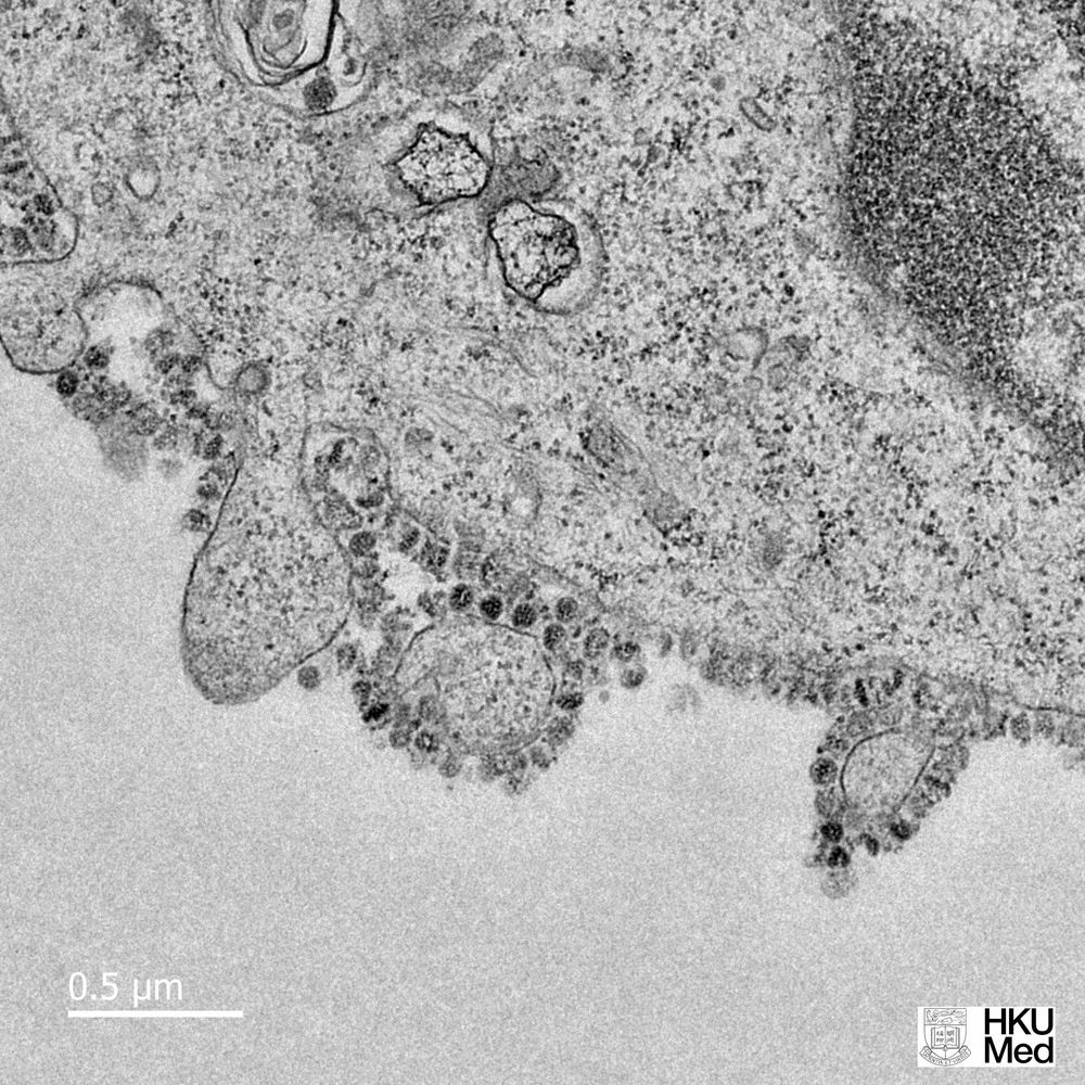 细胞中生长的2019年新型冠状病毒的电子显微镜图像